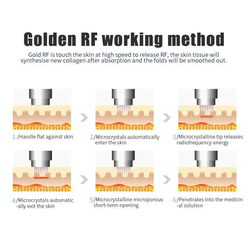 Gold Microneedling: Precision Skin Rejuvenation at Its Finest - 图片 4